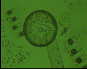 Plankton - Plankton, Algen, Kieselalgen, Diatomeen, Meer, Nordsee, Bakterien, Phytoplankton
