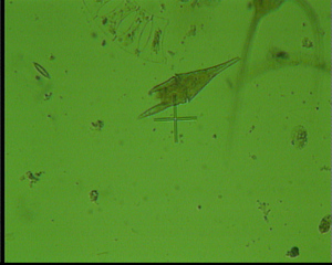 Ceratium furca - Plankton, Algen, Kieselalgen, Phytoplankton, Meer, Nordsee, Mikroskopie, Grünalgen, Alge