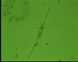 Ceratium fusus - Plankton, Algen, Kieselalgen, Phytoplankton, Meer, Nordsee, Mikroskopie, Alge