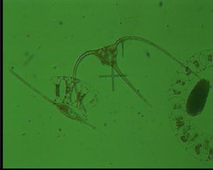 Ceratium horridum - Plankton, Algen, Kieselalgen, Phytoplankton, Meer, Nordsee, Mikroskopie, Alge