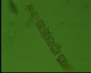 Chaetoceros sp. - Plankton, Algen, Kieselalgen, Phytoplankton, Meer, Nordsee, Mikroskopie