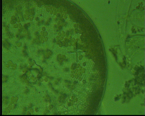 Coscinodiscus concinnus - Plankton, Algen, Kieselalgen, Phytoplankton, Meer, Nordsee, Mikroskopie, Diatomeen, Alge