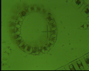 Eucampia zoodiacum - Plankton, Algen, Kieselalgen, Phytoplankton, Meer, Nordsee, Mikroskopie, Diatomeen, Alge