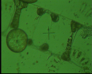 Kieselalgen - Plankton, Algen, Kieselalgen, Phytoplankton, Meer, Nordsee, Mikroskopie, Diatomeen, Alge, grün