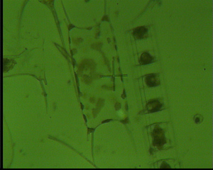 Biddulphia sinensis - Plankton, Algen, Kieselalgen, Phytoplankton, Meer, Nordsee, Mikroskopie, Diatomeen, Alge, grün