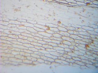 Zwiebelhaut - Zwiebel, Zelle, Zellwand, Mikroskop